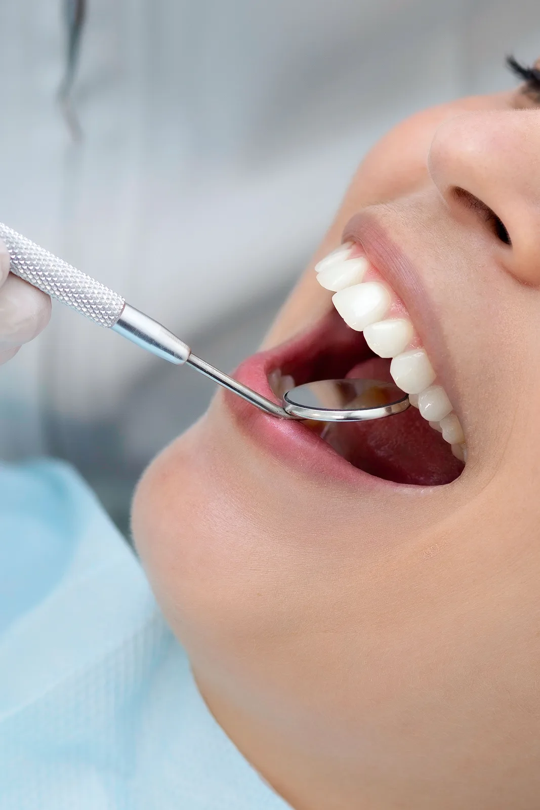 Checking restoration margins with a dental mirror, shown while covering Implant Procedures in Virginia Beach