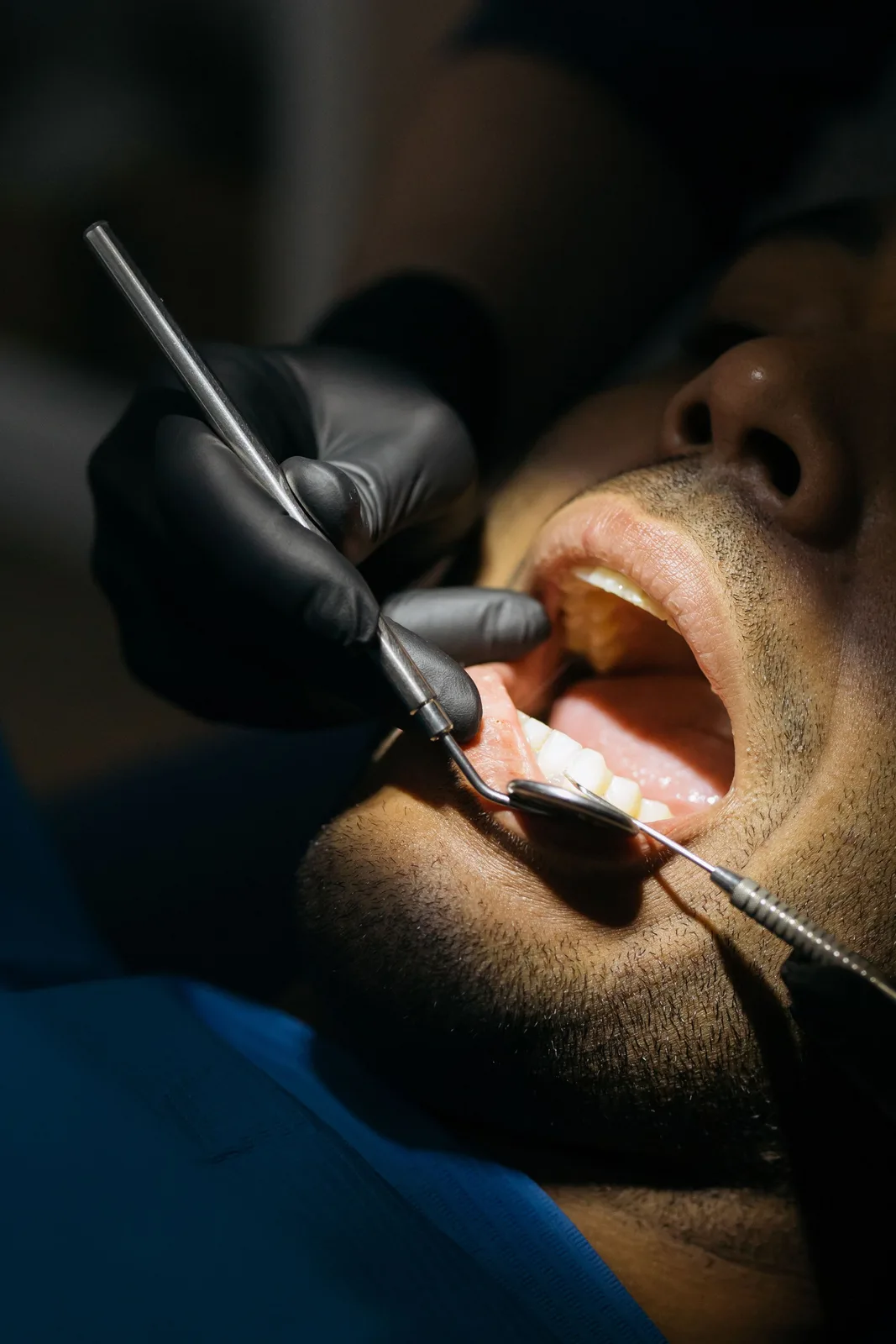 Close-up of a dental examination, referred to in the Dental Implants section for Virginia Beach