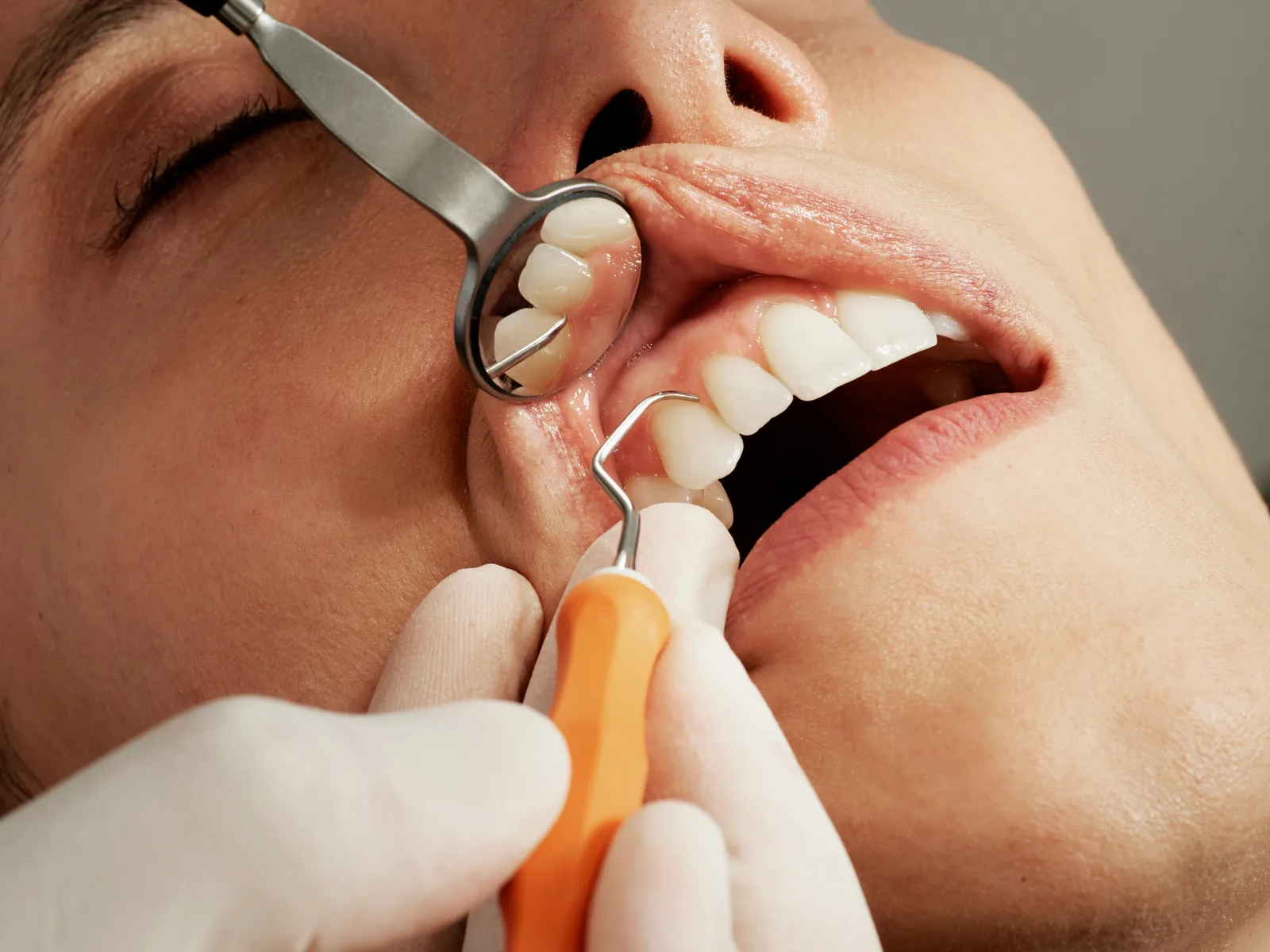 Dental examination with mirror and probe at a consultation in Virginia Beach