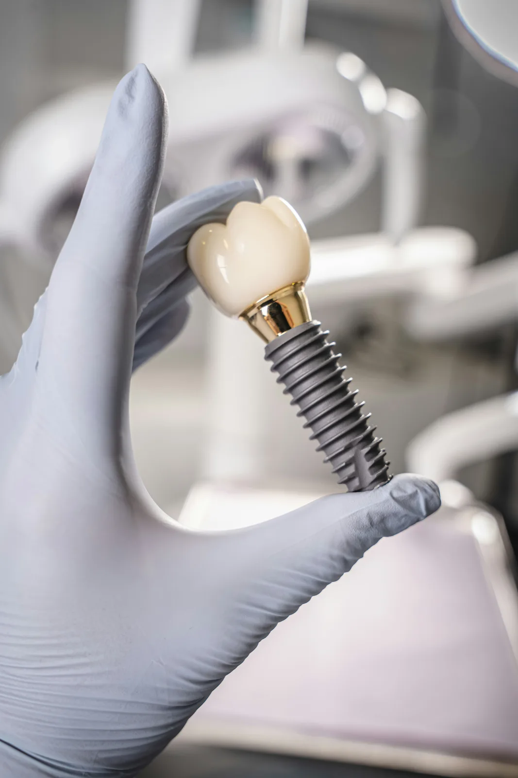 Dental implant fixture, abutment and crown, referred to in the dental implant treatment section for Virginia Beach