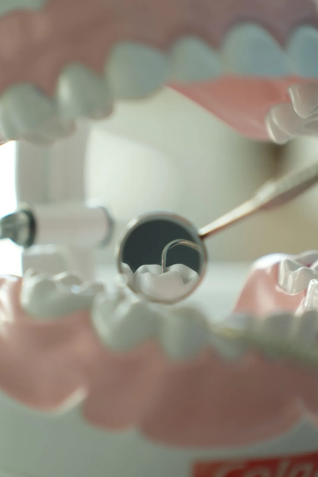 Dental mirror view inside the mouth, referred to in the Bone Grafting section for Virginia Beach