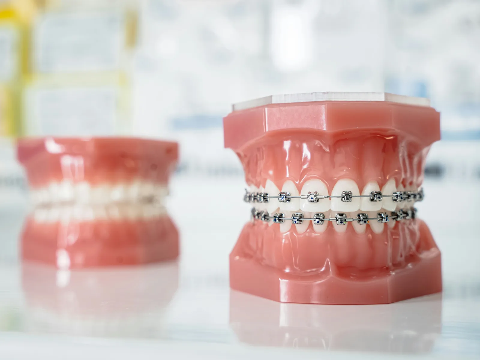 Dental study models at the practice, shown while covering Sinus Lift Surgery in Virginia Beach