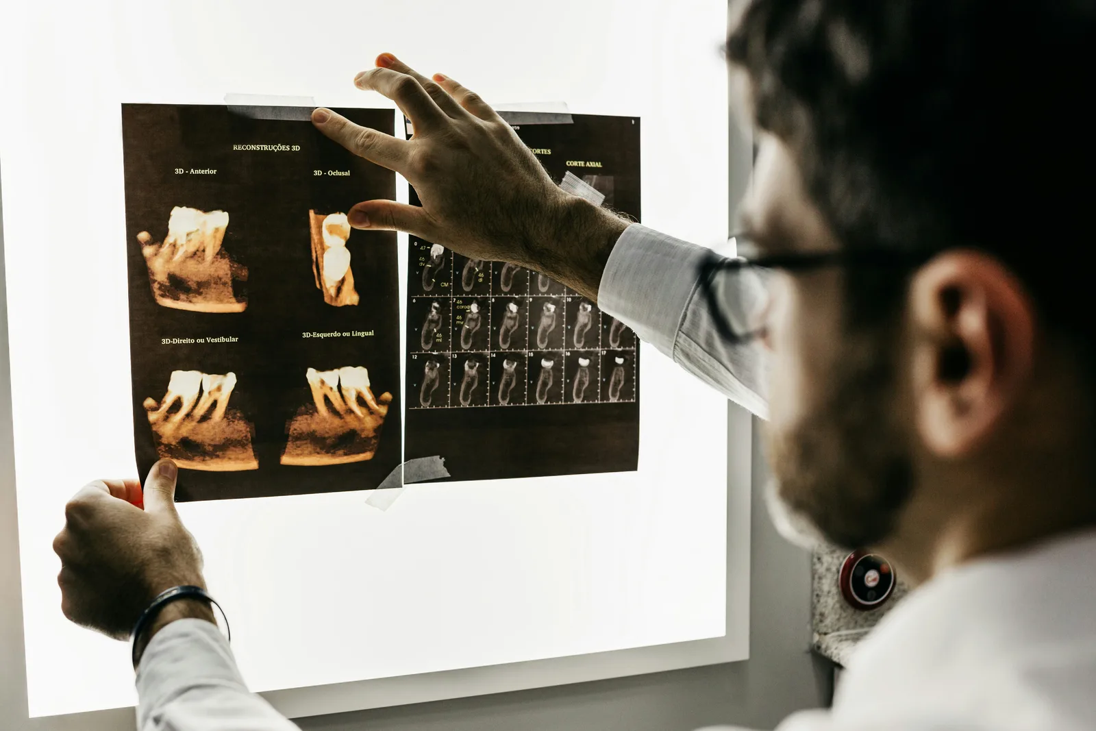 Dentist reviewing a CBCT scan before implant surgery, alongside the dental implant treatment explanation in Virginia Beach