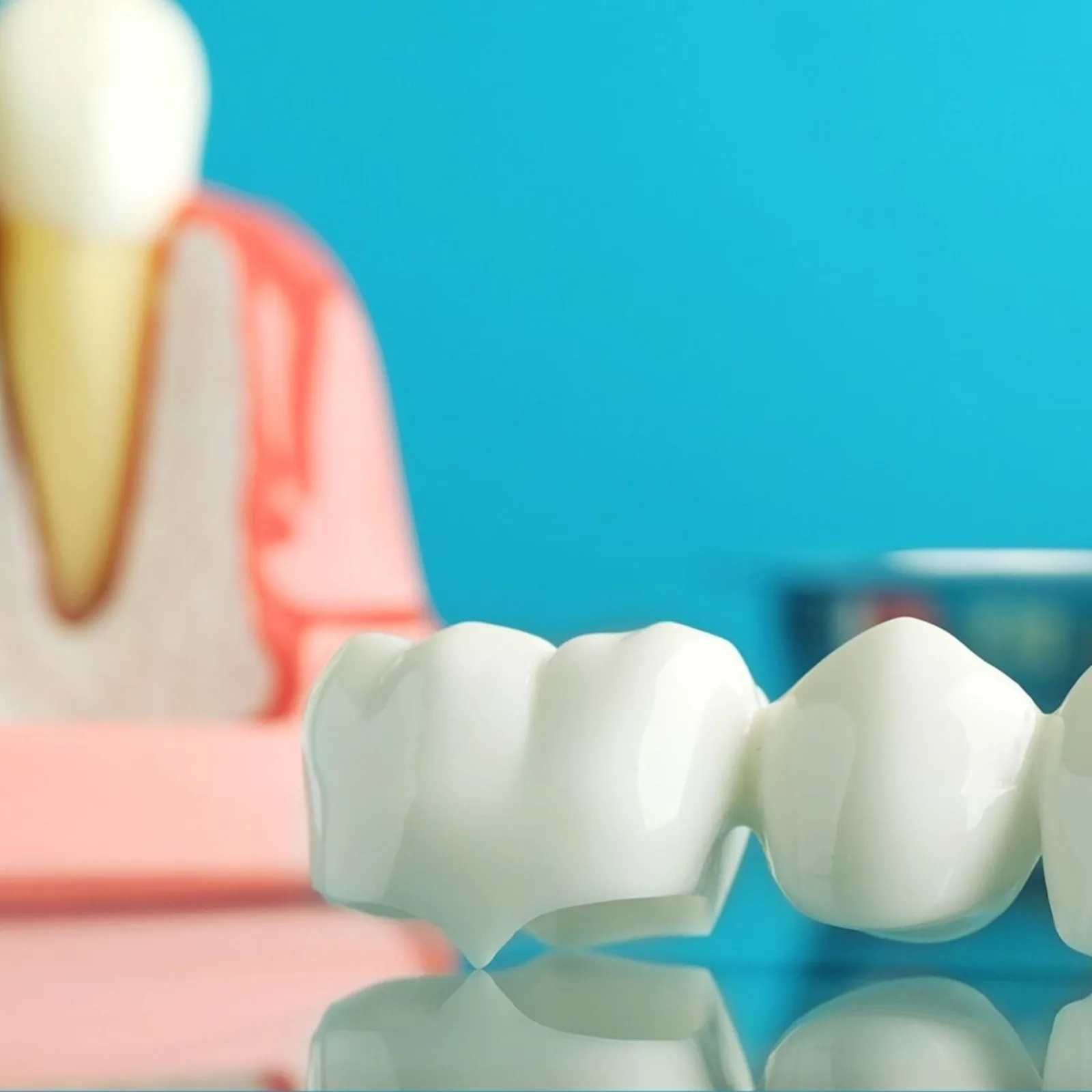 Implant and crown model on display, alongside the CBCT Imaging explanation in Virginia Beach