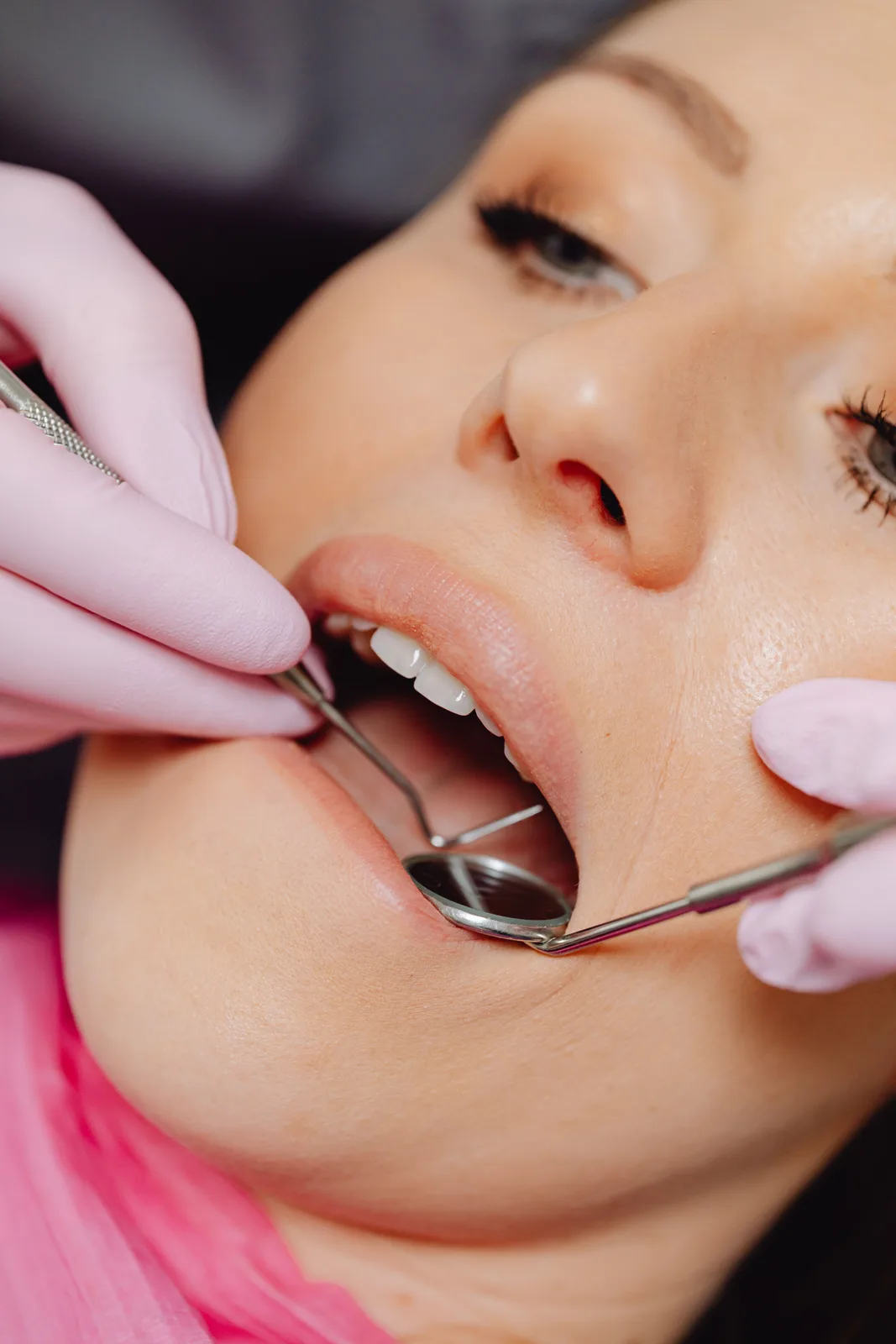 Mirror and probe exam of the lower arch, alongside the All-on-4 Implants explanation in Virginia Beach