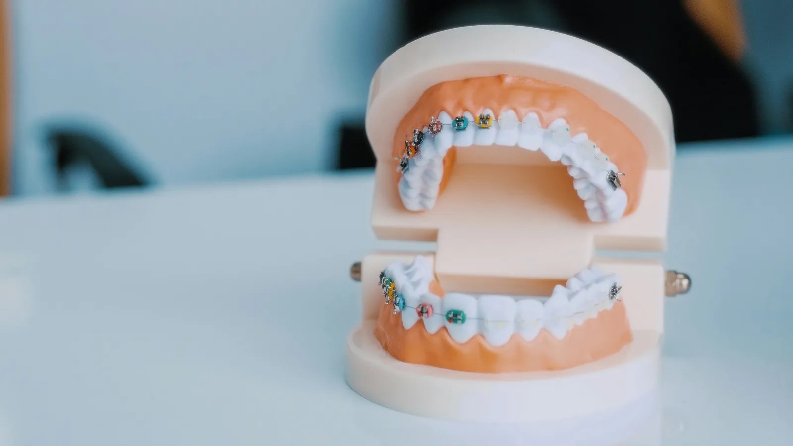 Dental model of the upper and lower arch, alongside the Implant Crown explanation in Virginia Beach