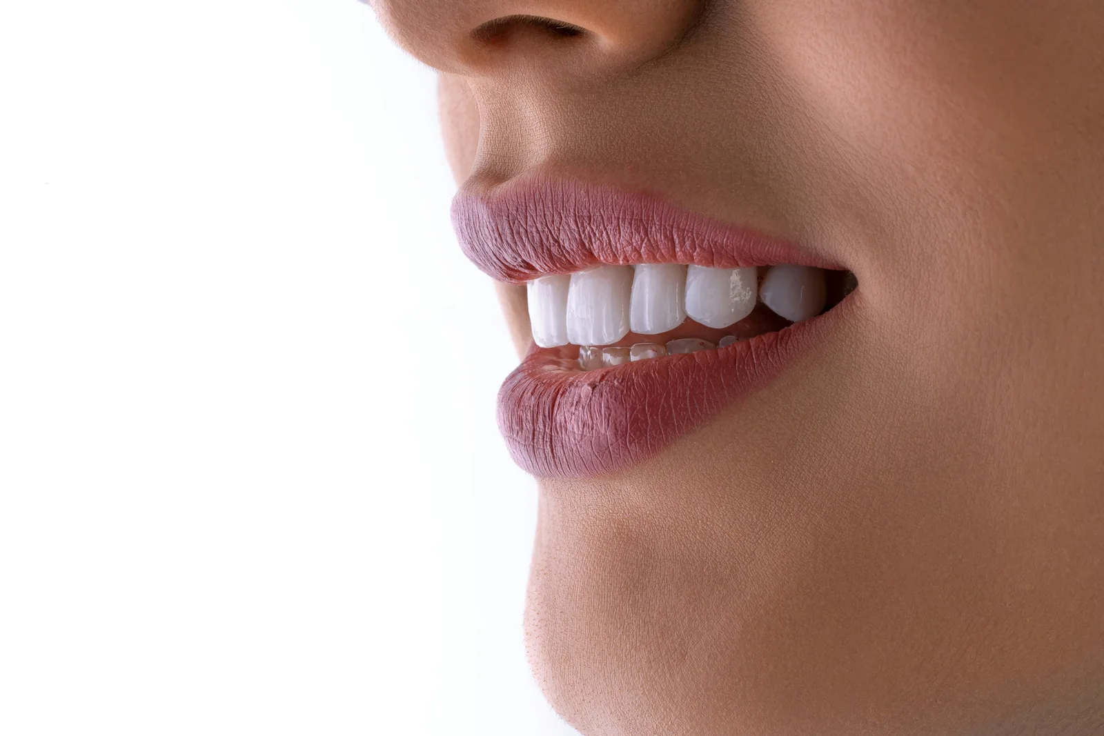 Patient profile smile after implant restoration, referred to in the Same Day Implants section for Virginia Beach