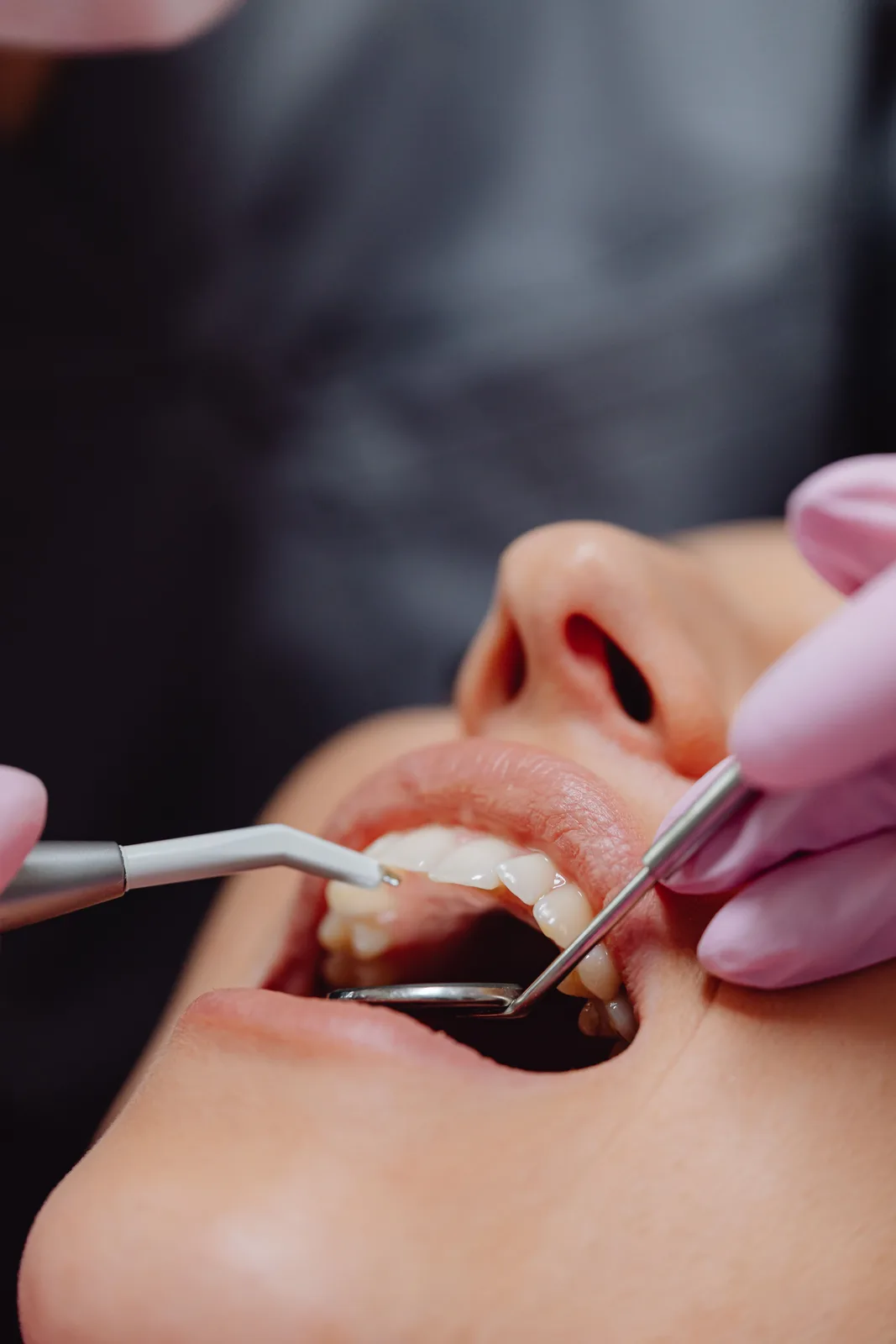 Polishing the teeth after treatment, referred to in the All-on-4 Implants section for Virginia Beach