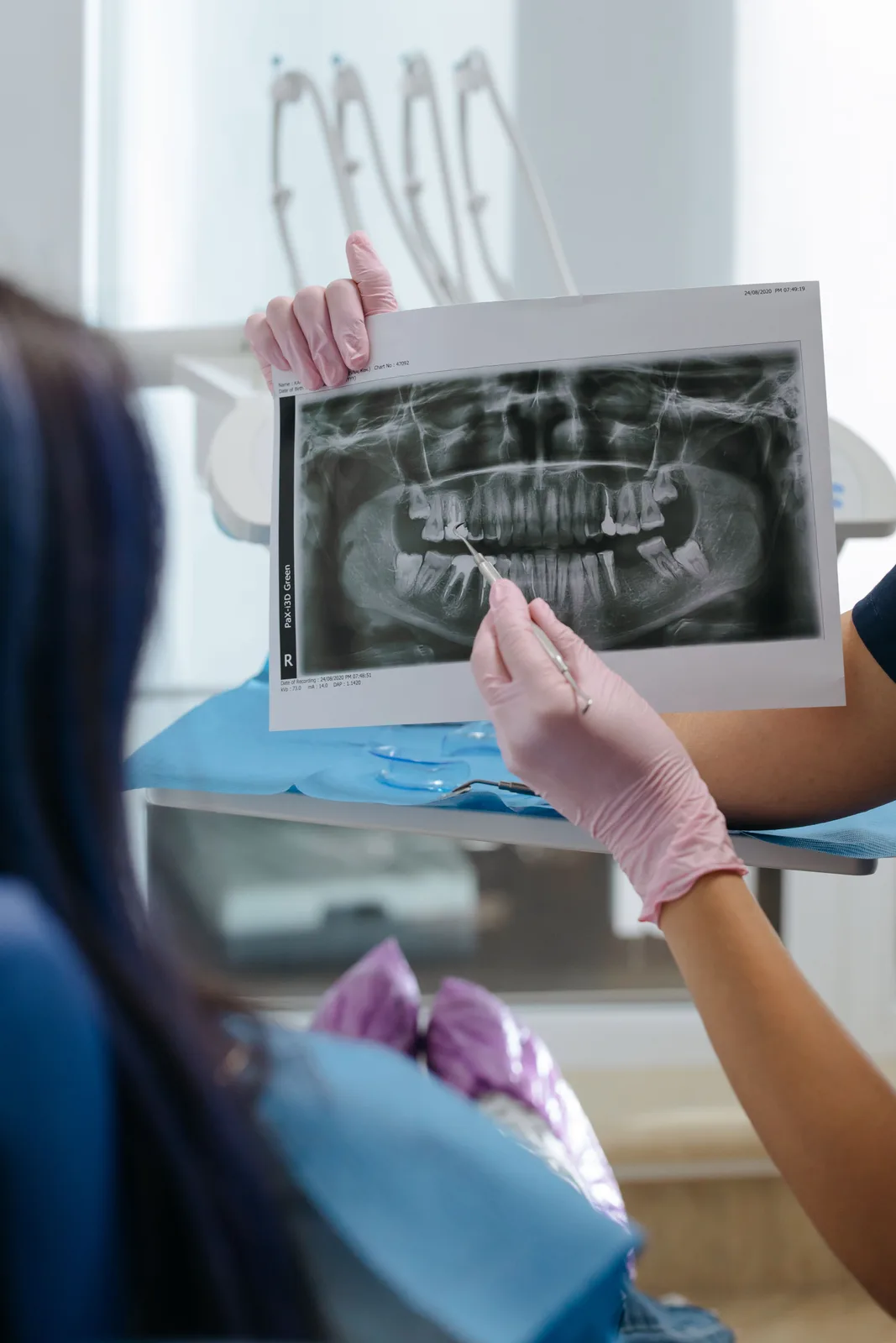 Reviewing a panoramic X-ray with a patient, shown while covering Dental Implants in Virginia Beach