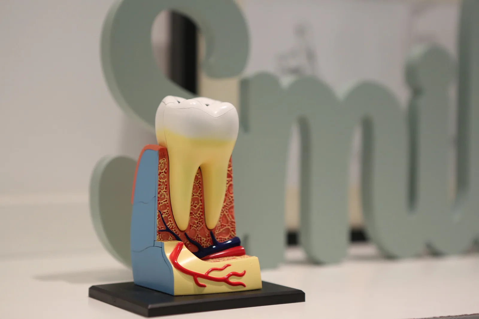 Tooth anatomy model showing the root below the gum, shown while covering Implant Cost in Virginia Beach