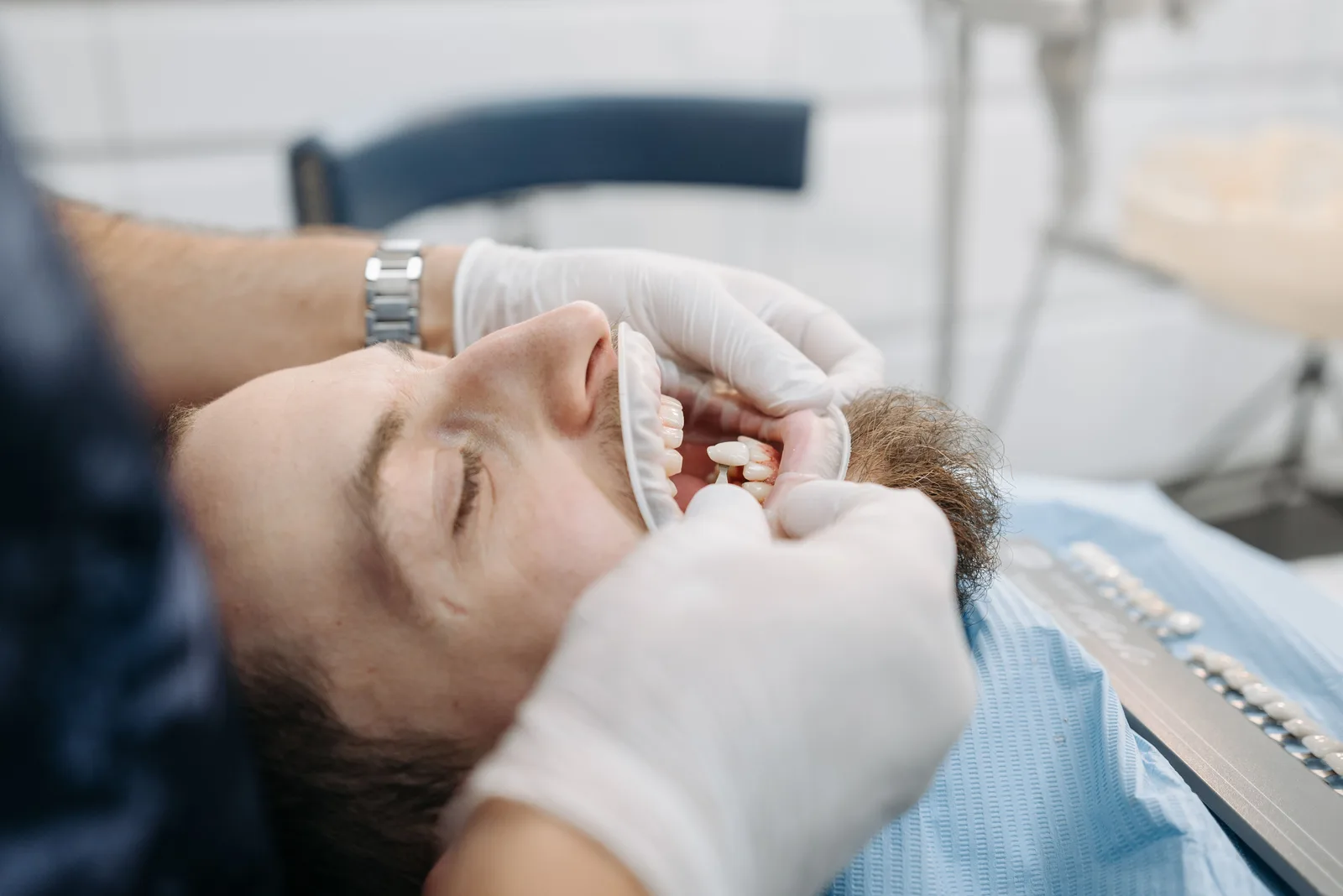 Trying in the shade for an implant crown, alongside the All-on-6 Implants explanation in Virginia Beach
