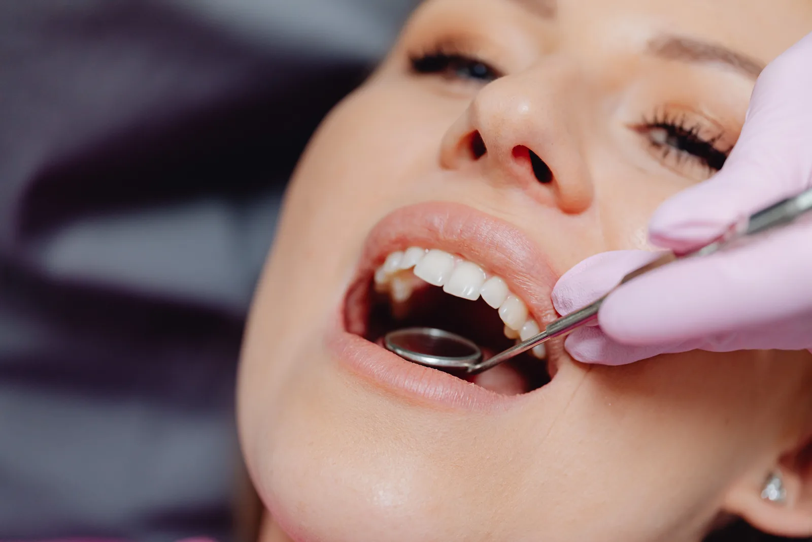 Upper arch exam with mirror and probe, shown while covering All-on-4 Implants in Virginia Beach
